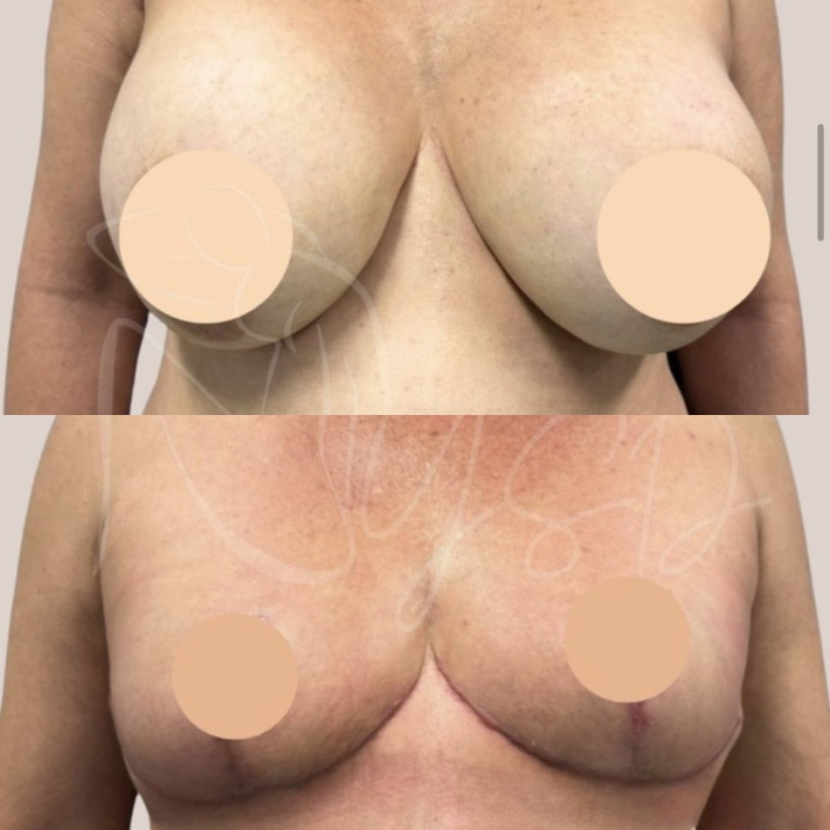 before and after photo