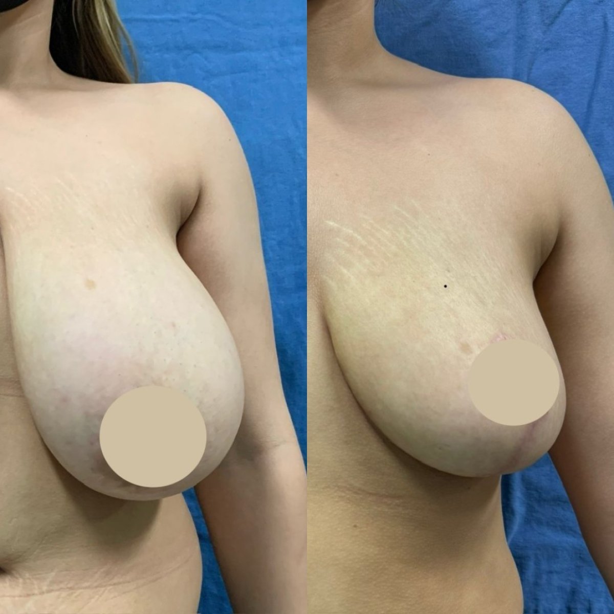 before and after photo