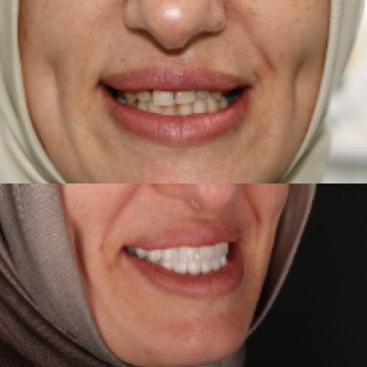 before and after photo