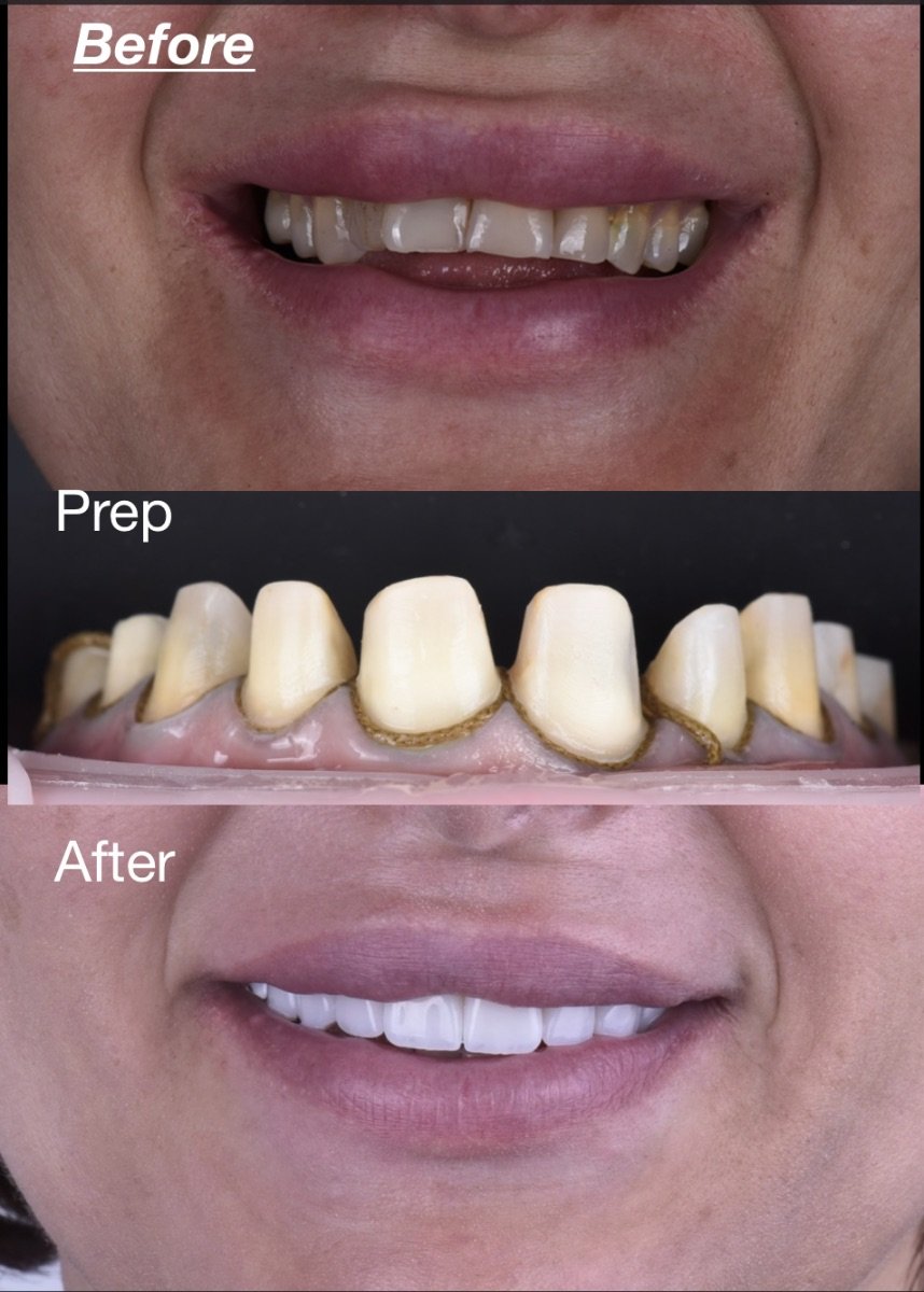 before and after photo