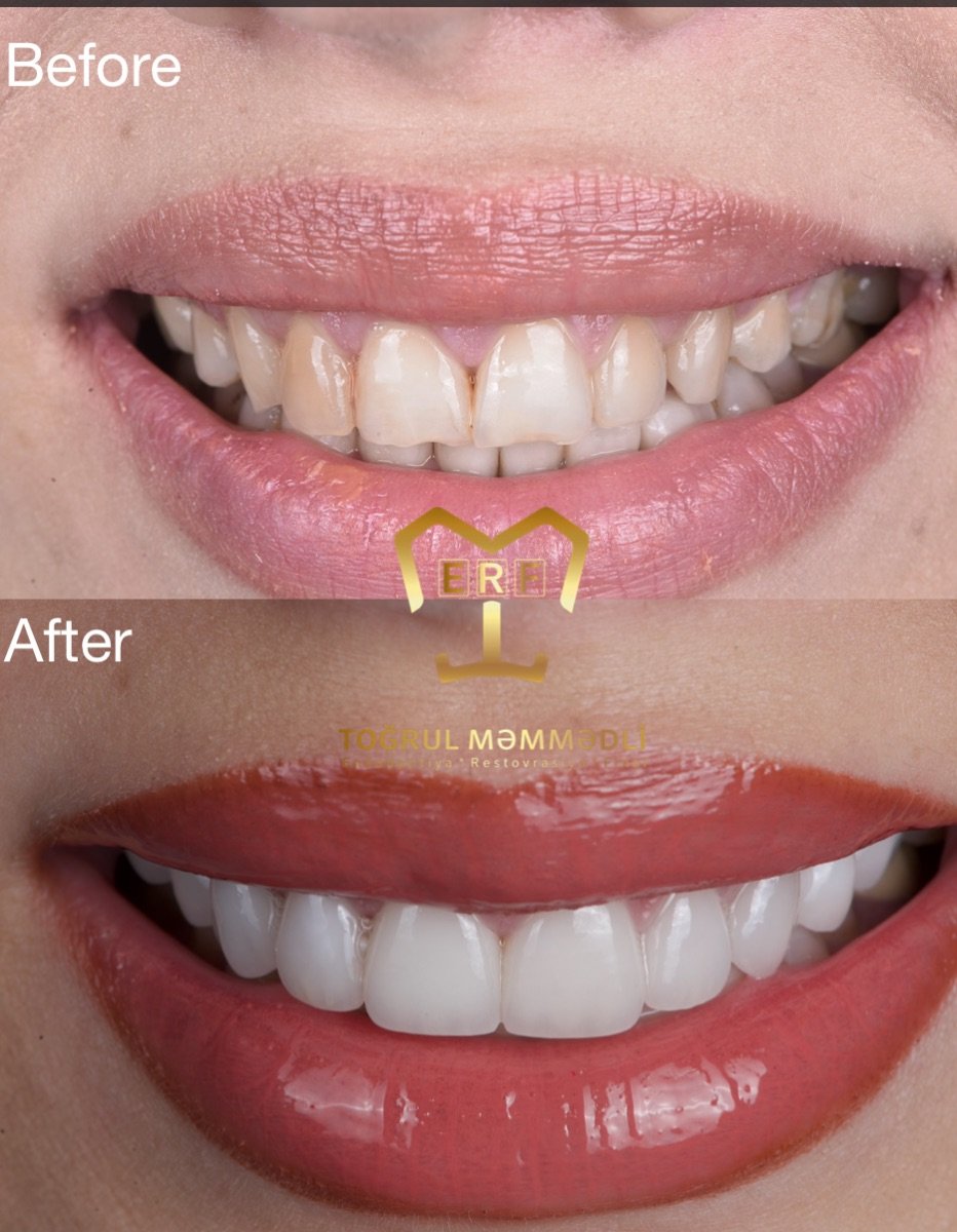 before and after photo