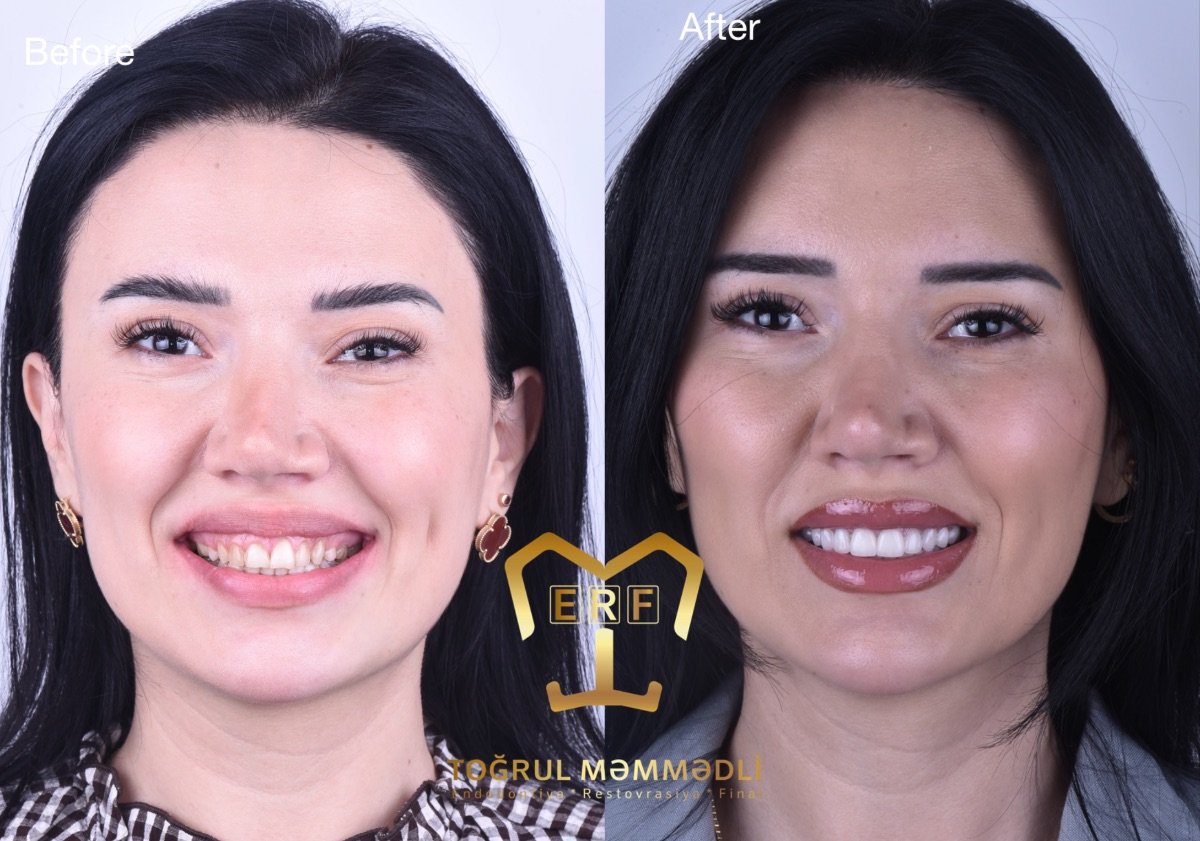 before and after photo