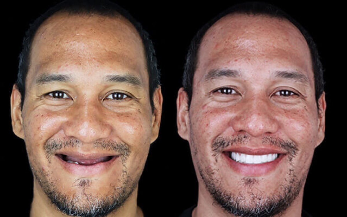 before and after photo