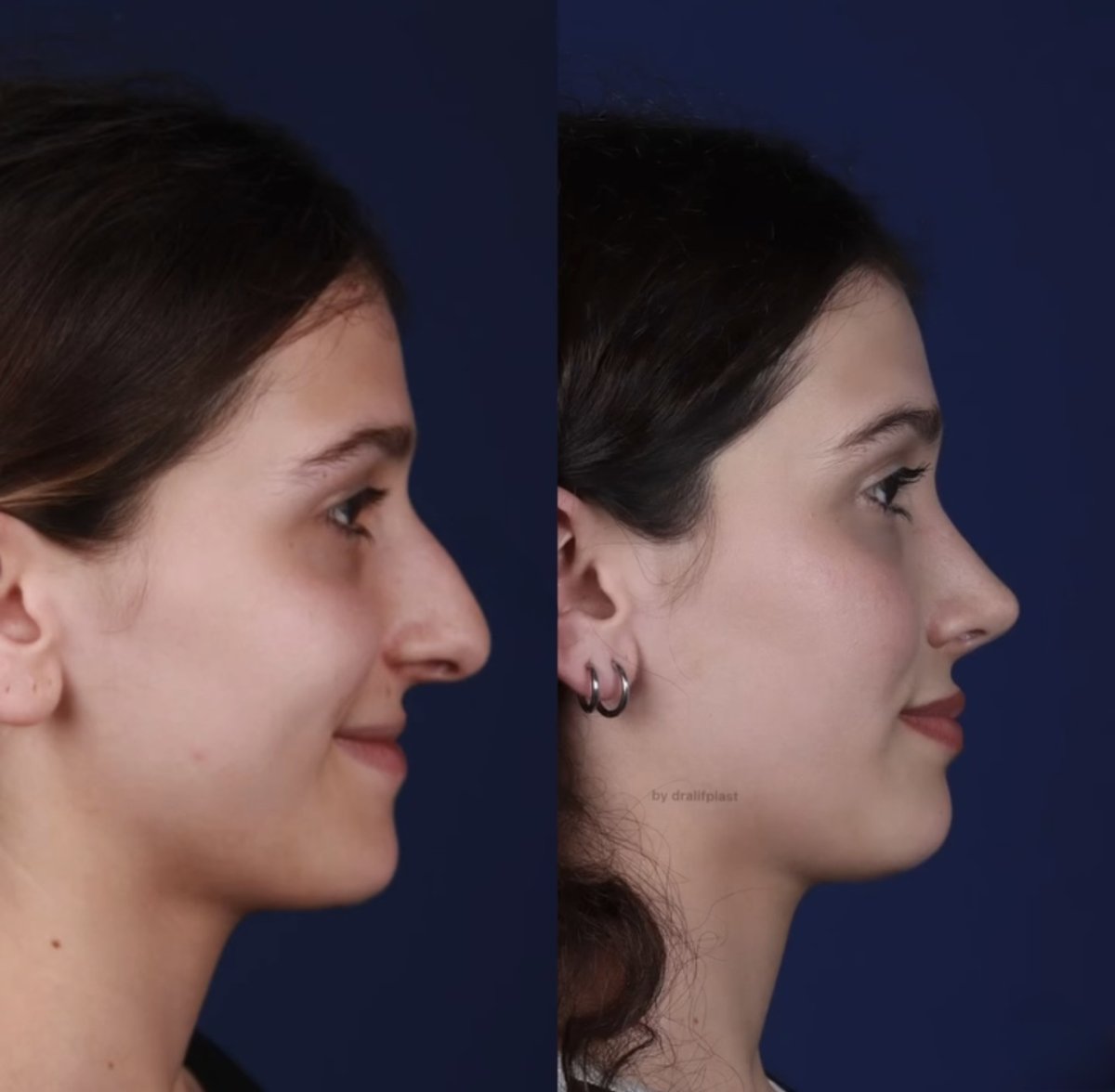 before and after photo