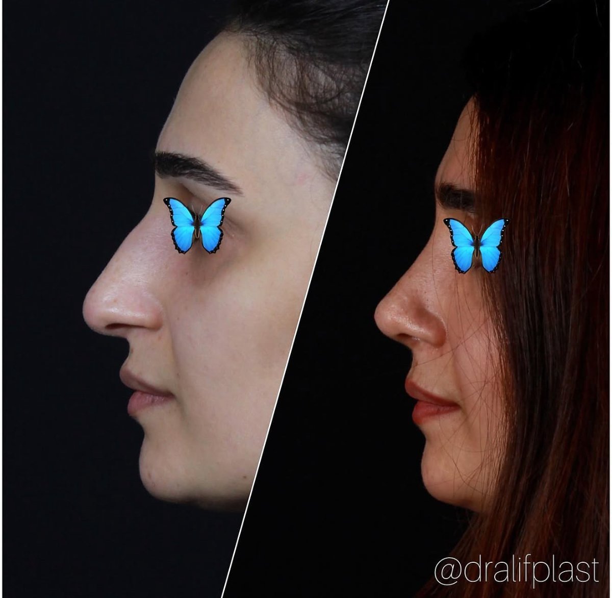 before and after photo
