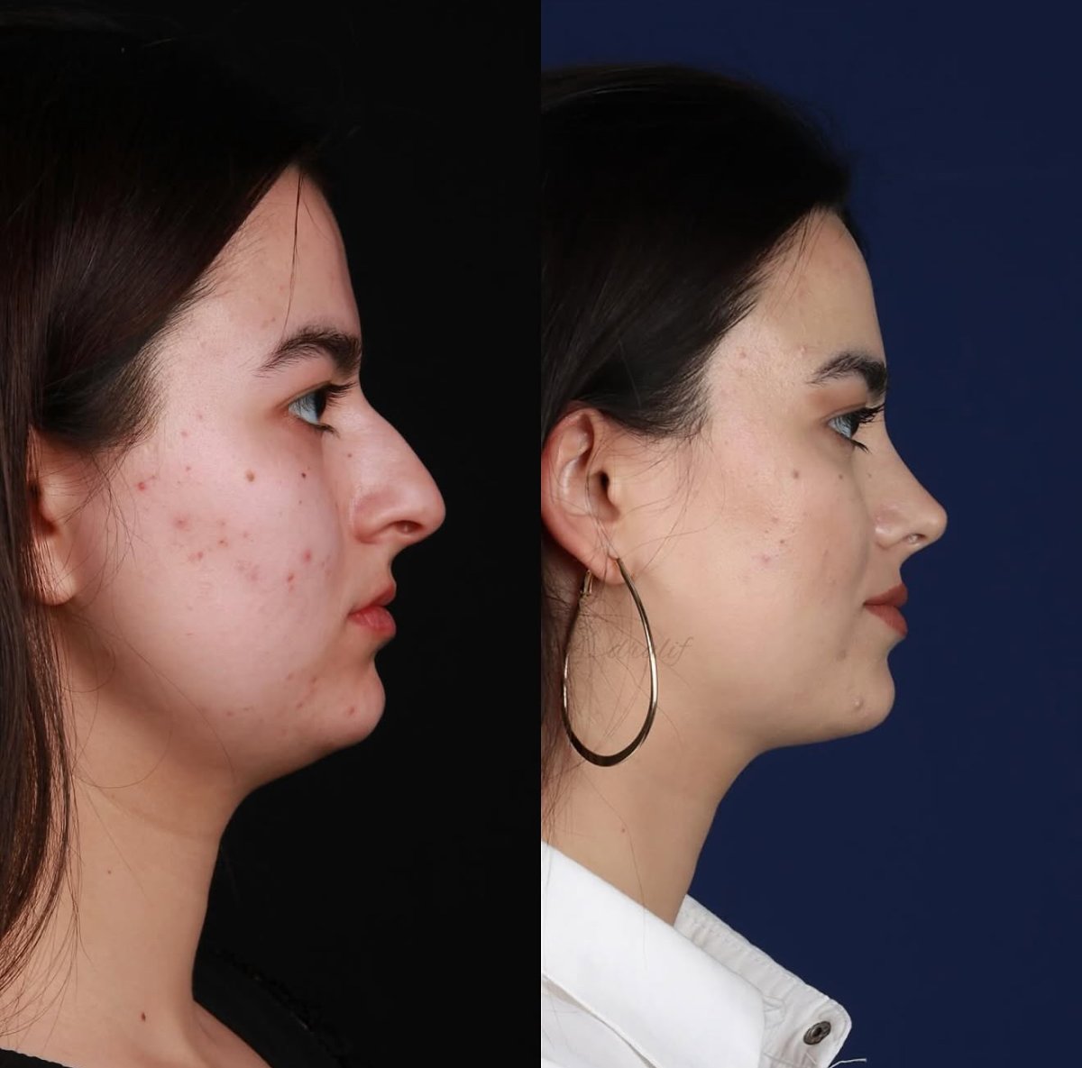 before and after photo