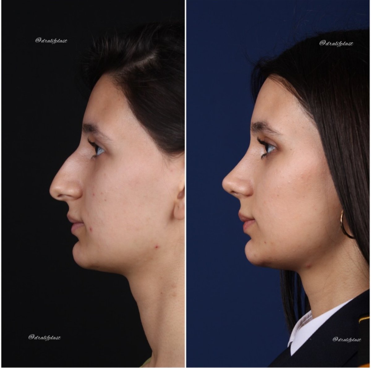 before and after photo