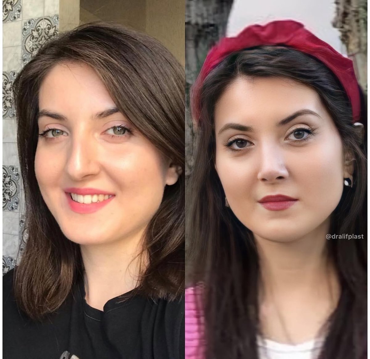 before and after photo
