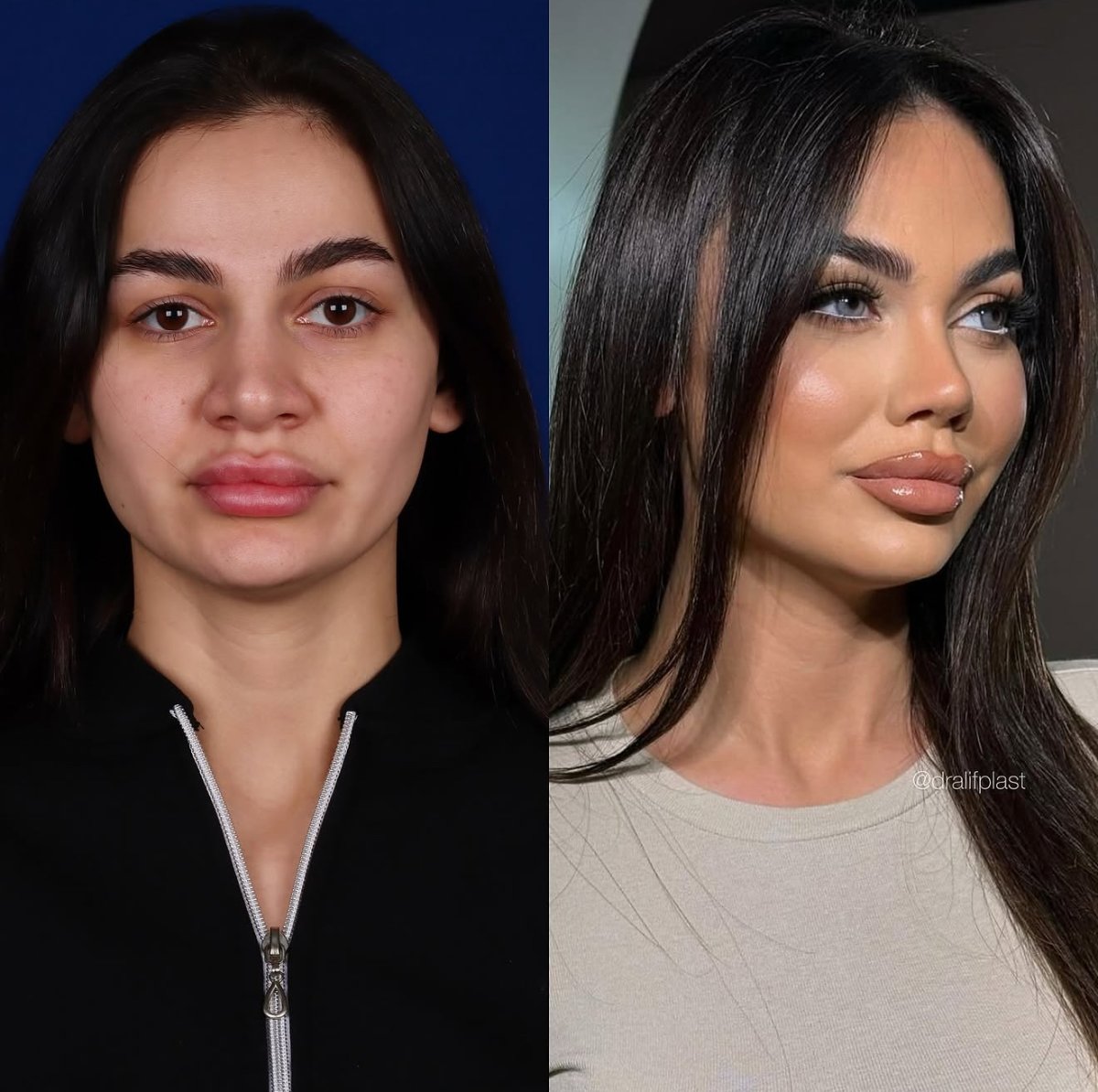 before and after photo