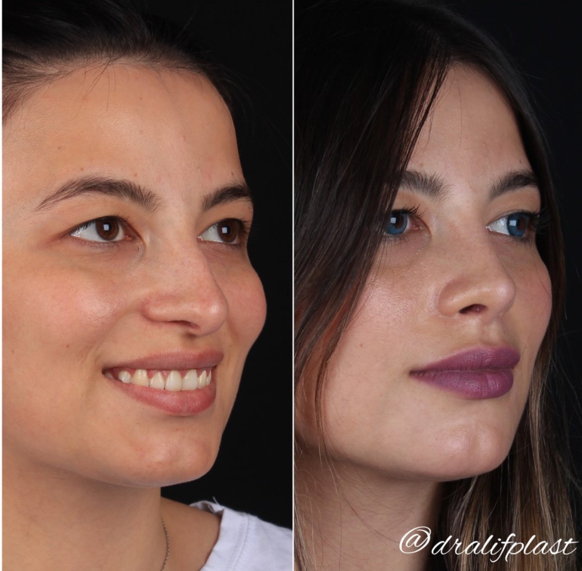 before and after photo