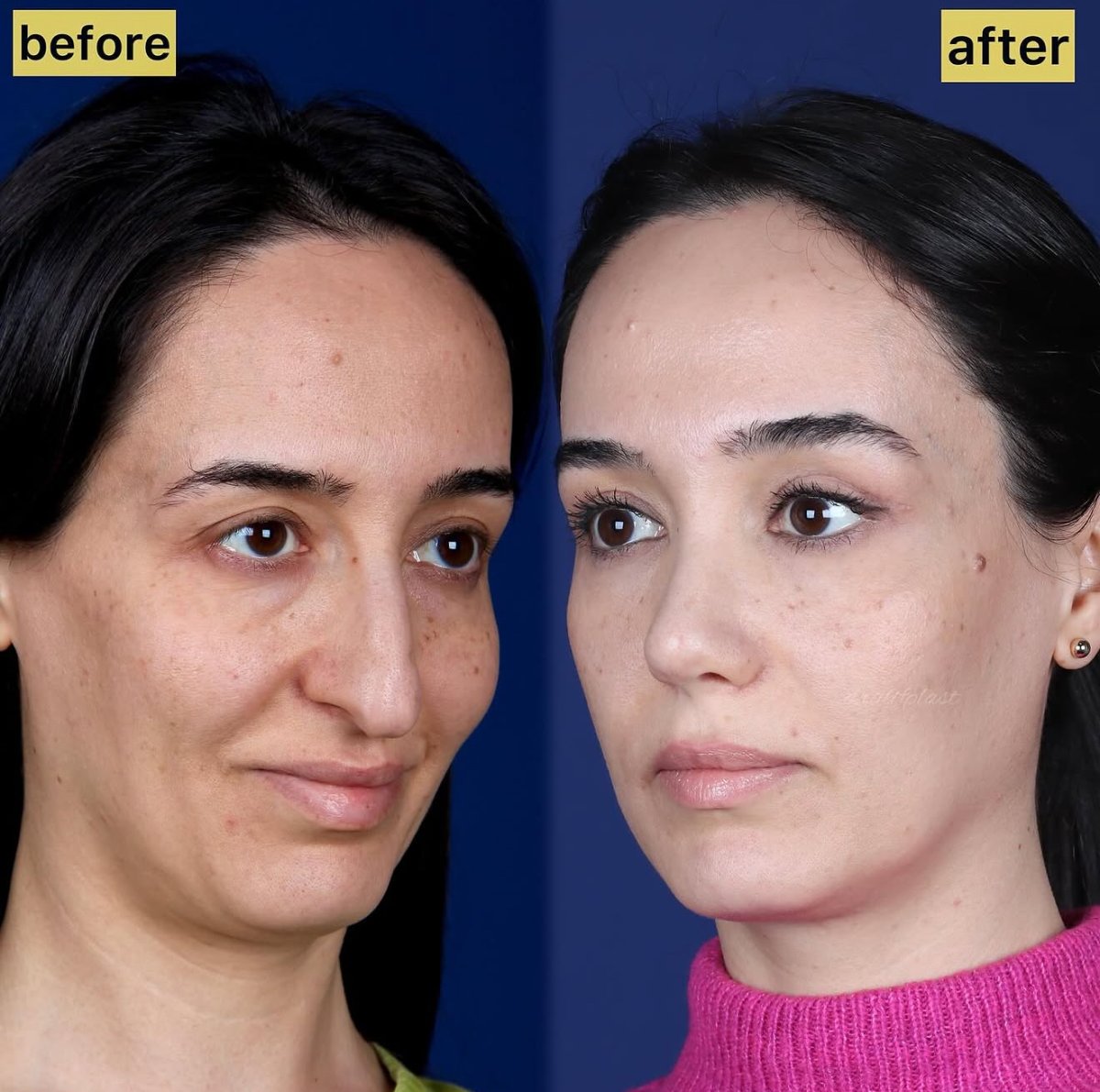 before and after photo
