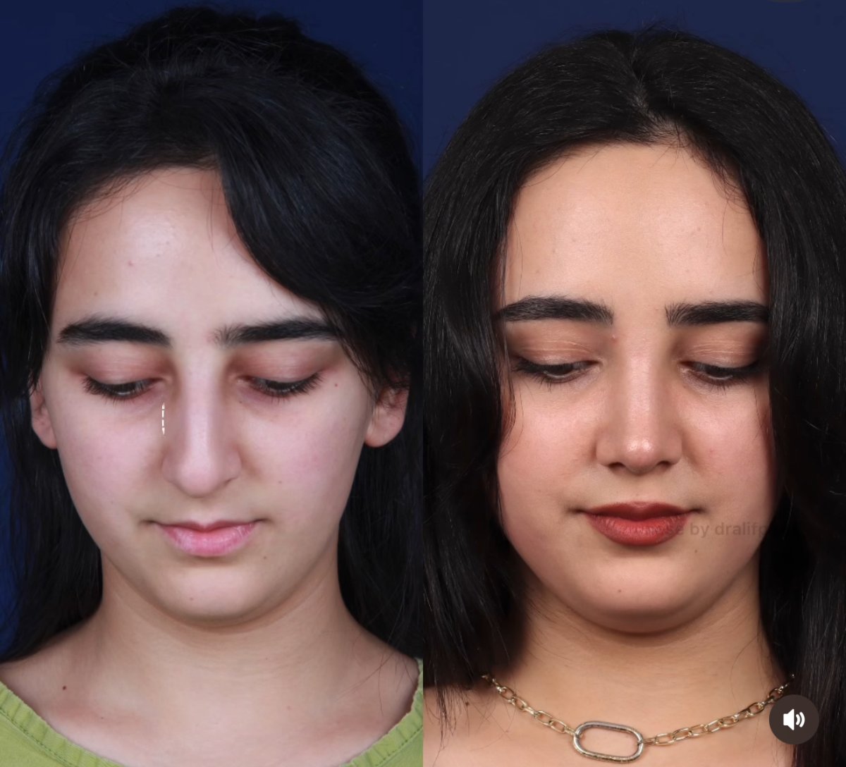 before and after photo