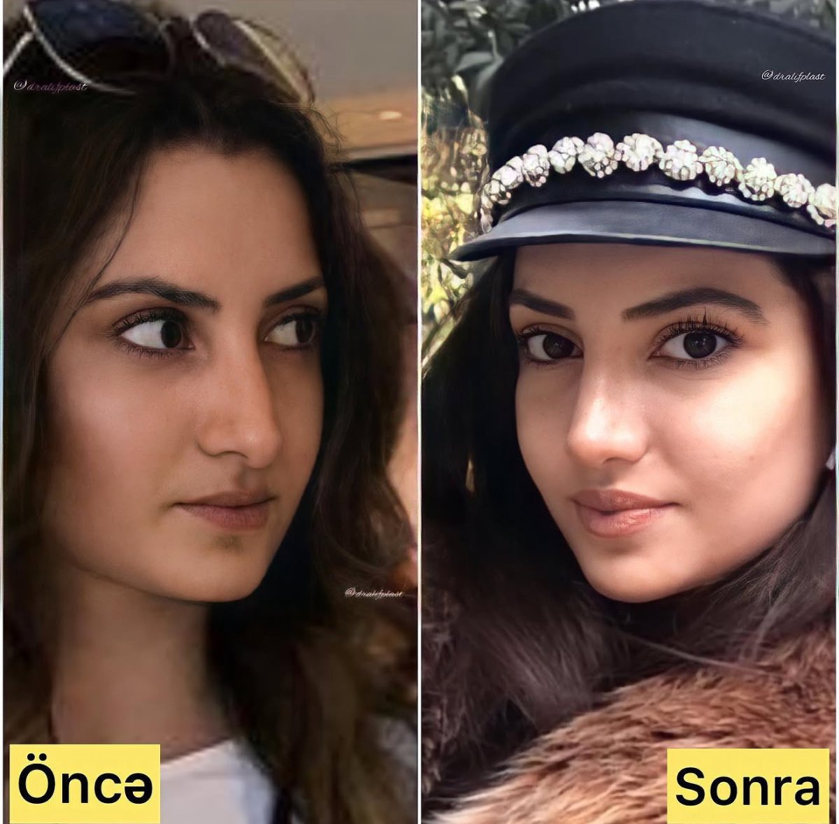 before and after photo