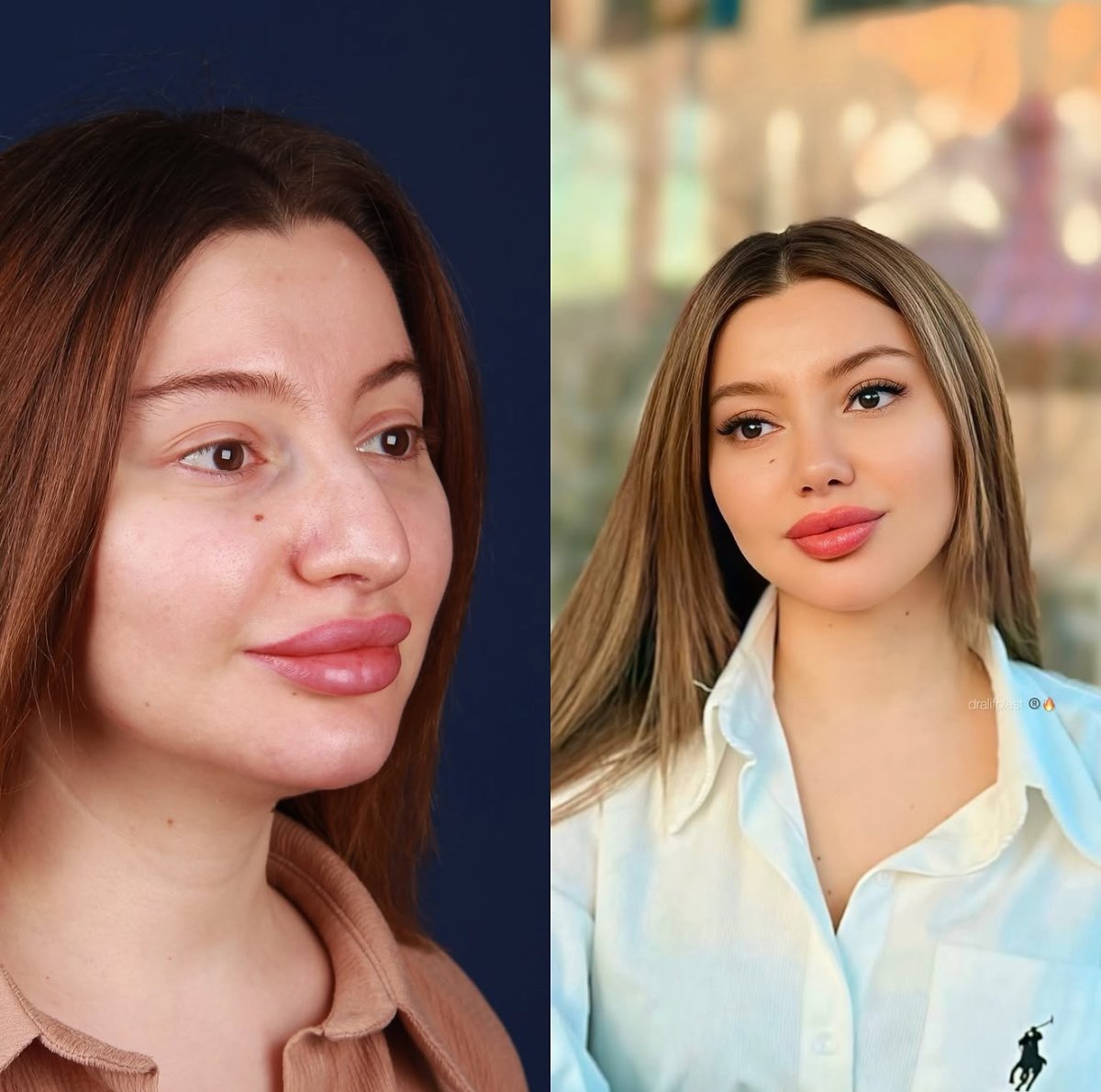 before and after photo