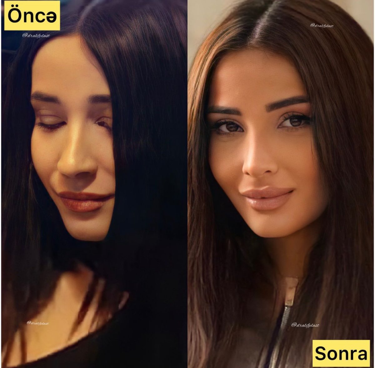 before and after photo