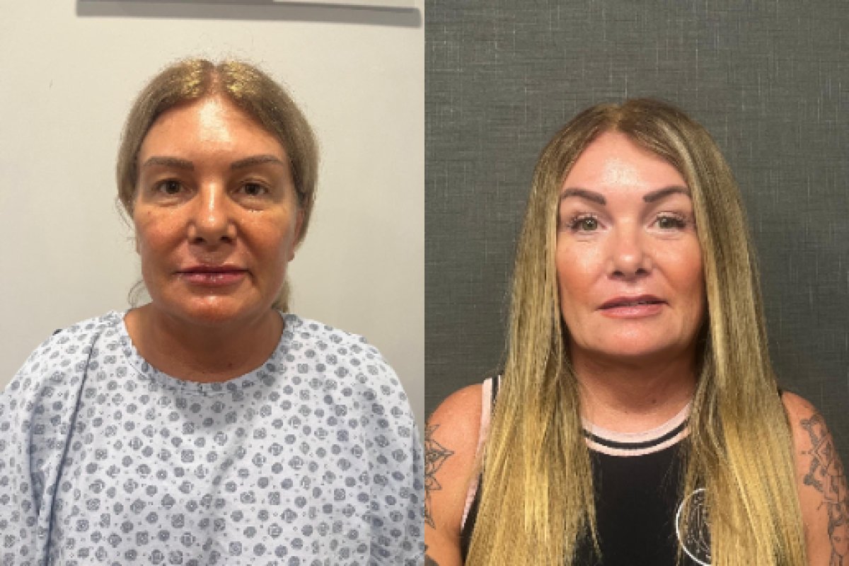 before and after photo