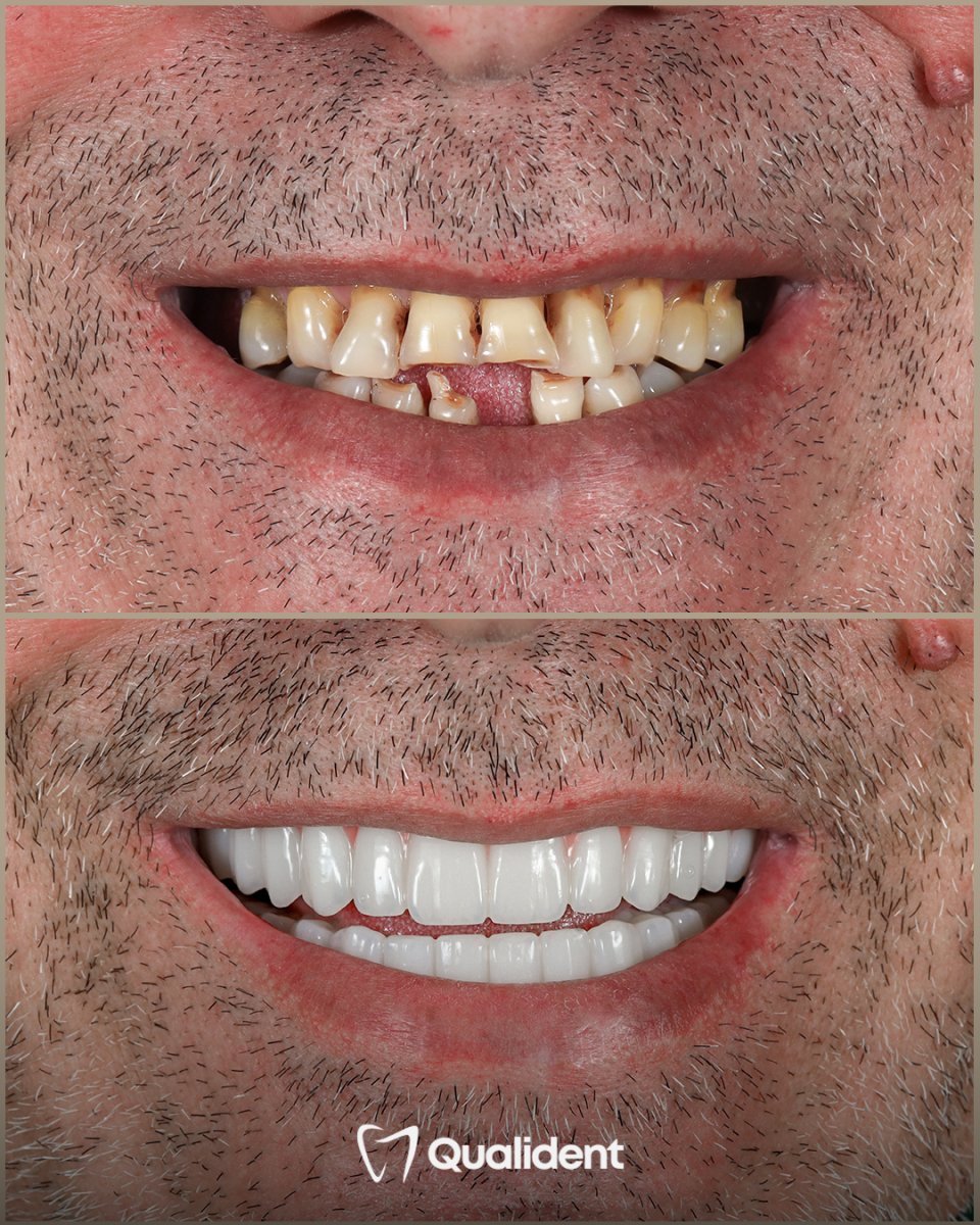 before and after photo