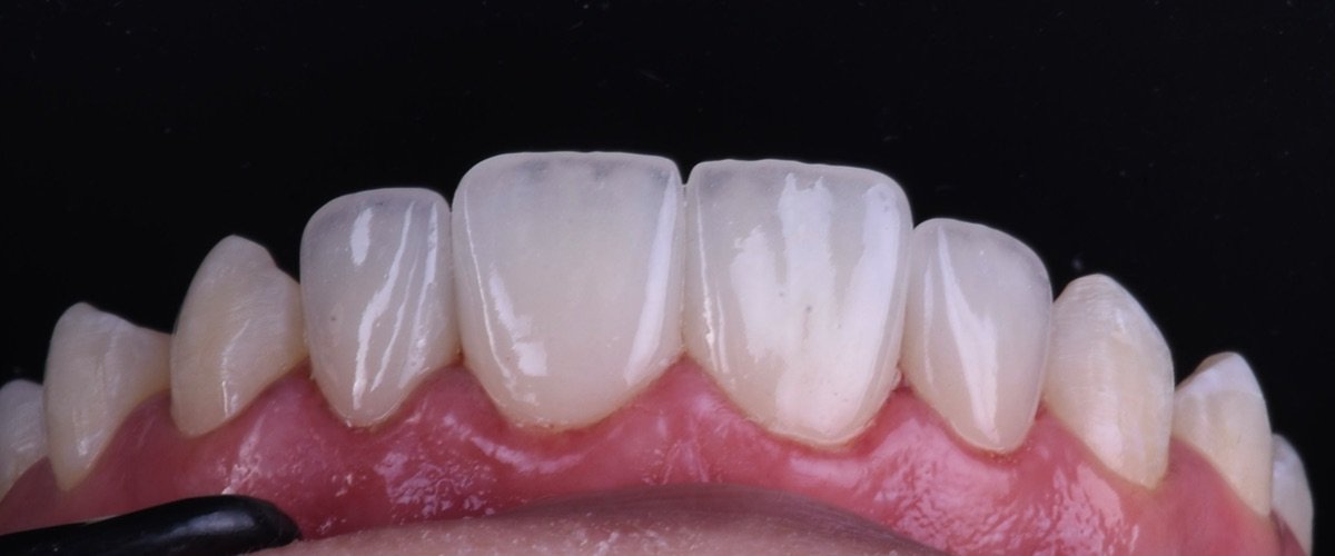 before and after photo