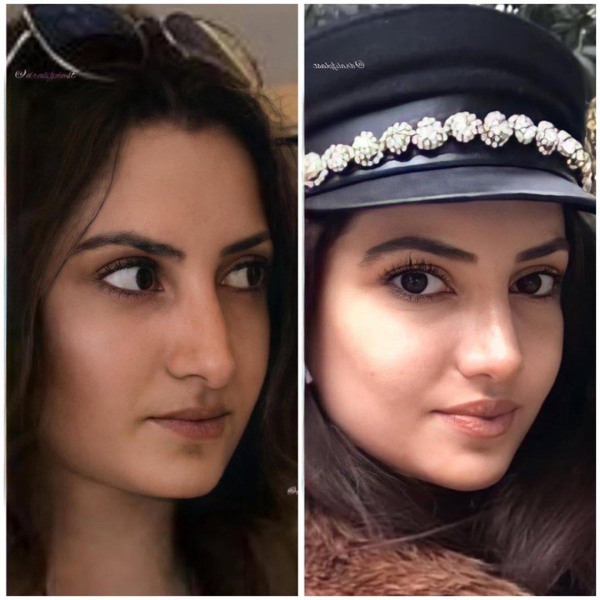 before and after photo