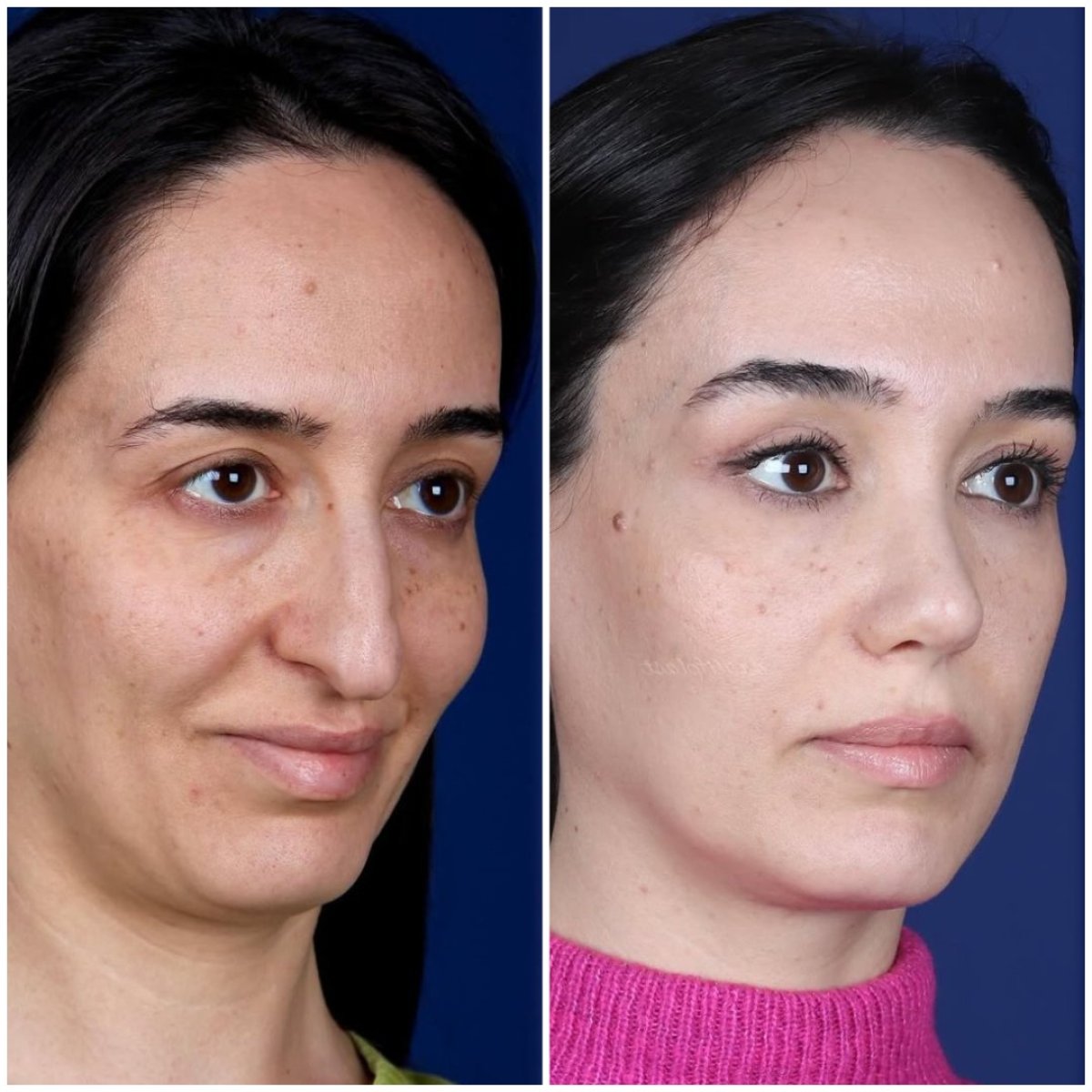 before and after photo