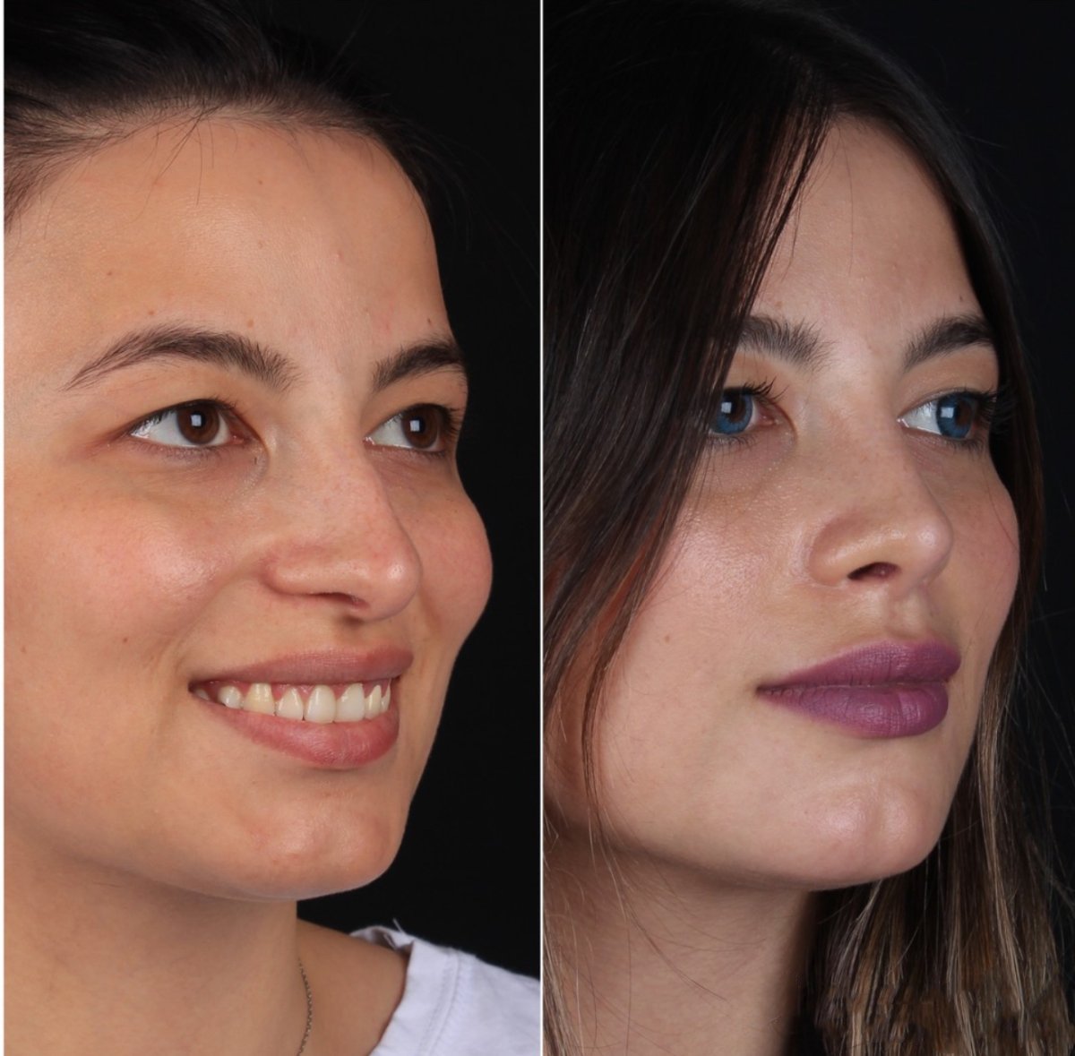 before and after photo