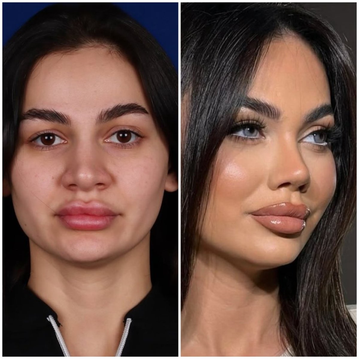 before and after photo