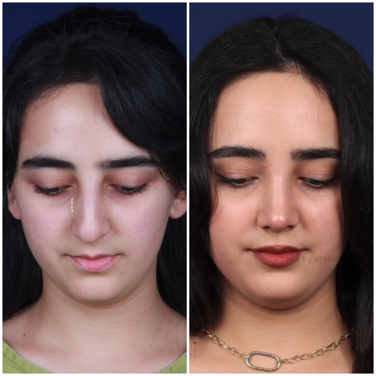 before and after photo