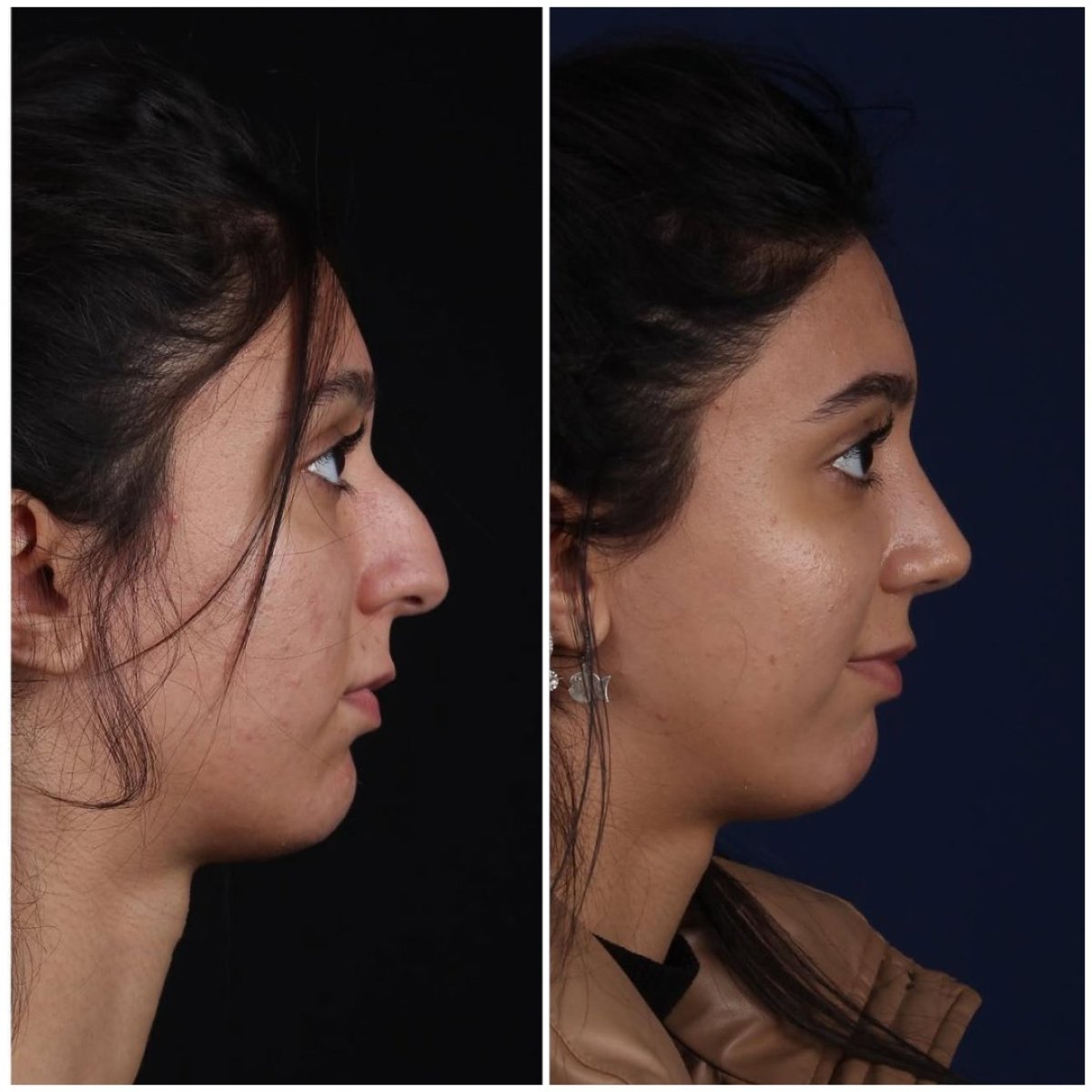 before and after photo