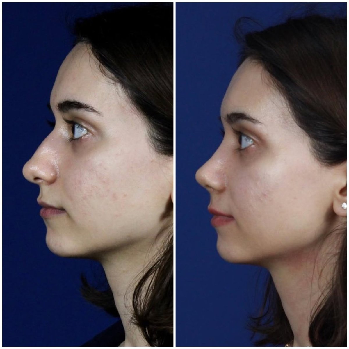 before and after photo