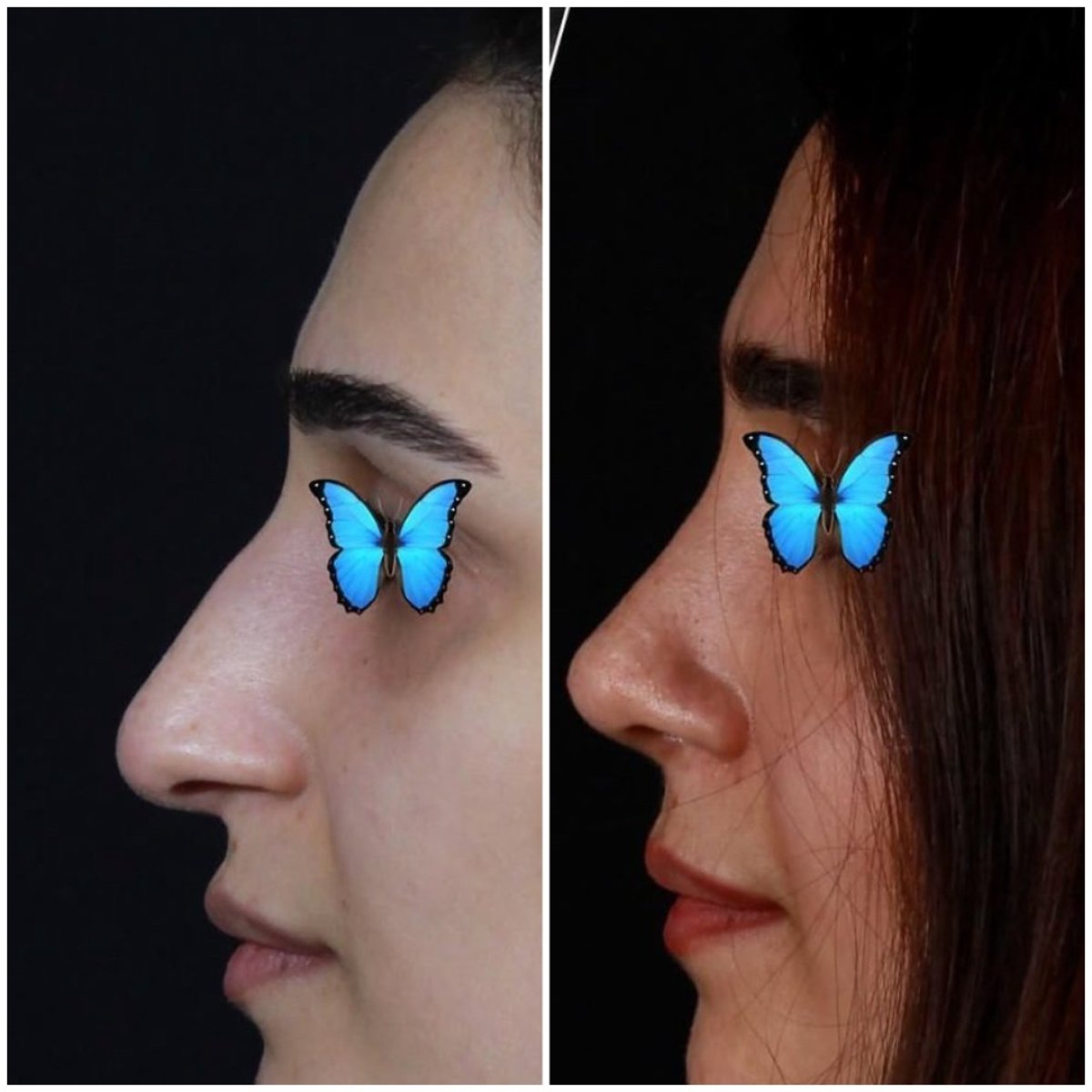 before and after photo