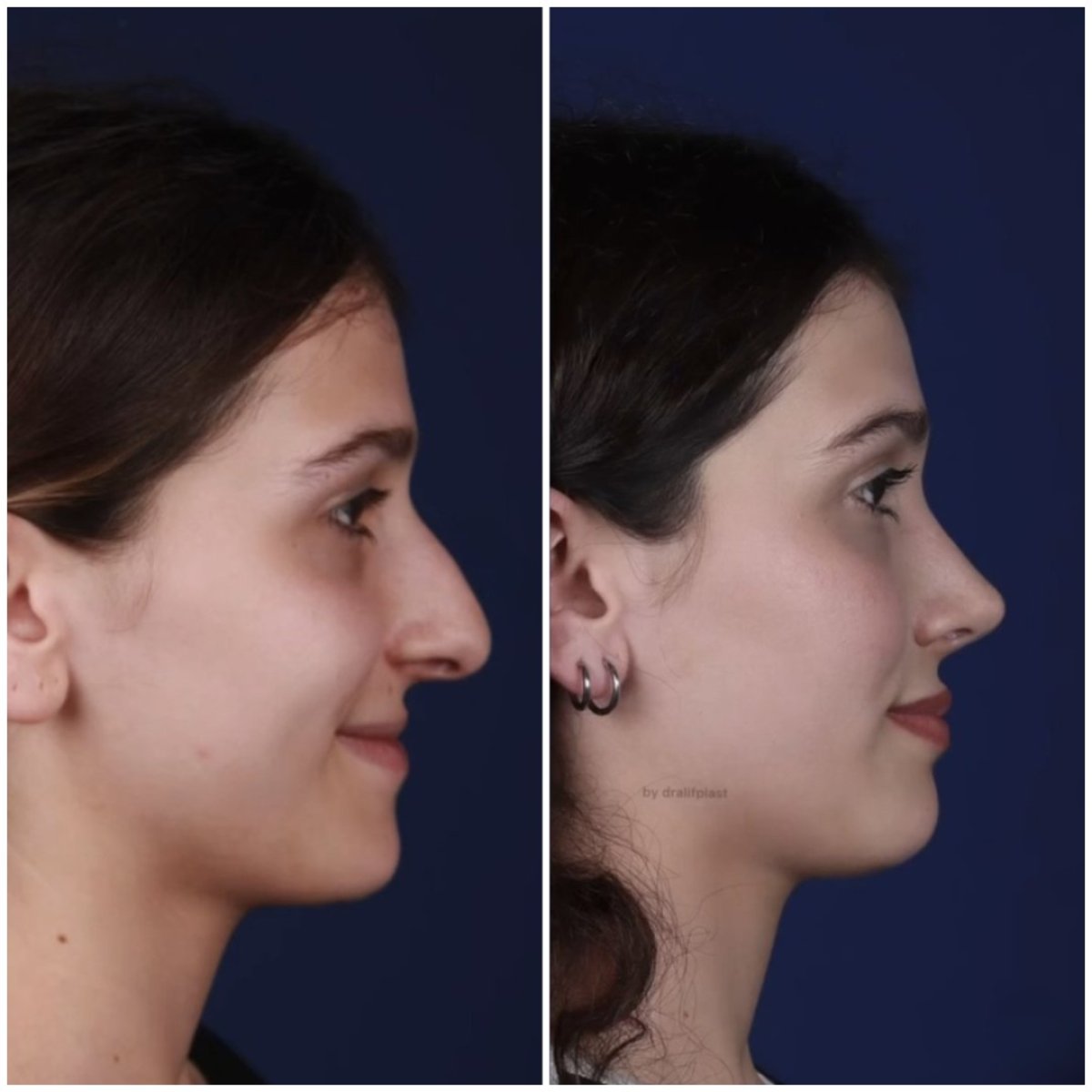before and after photo