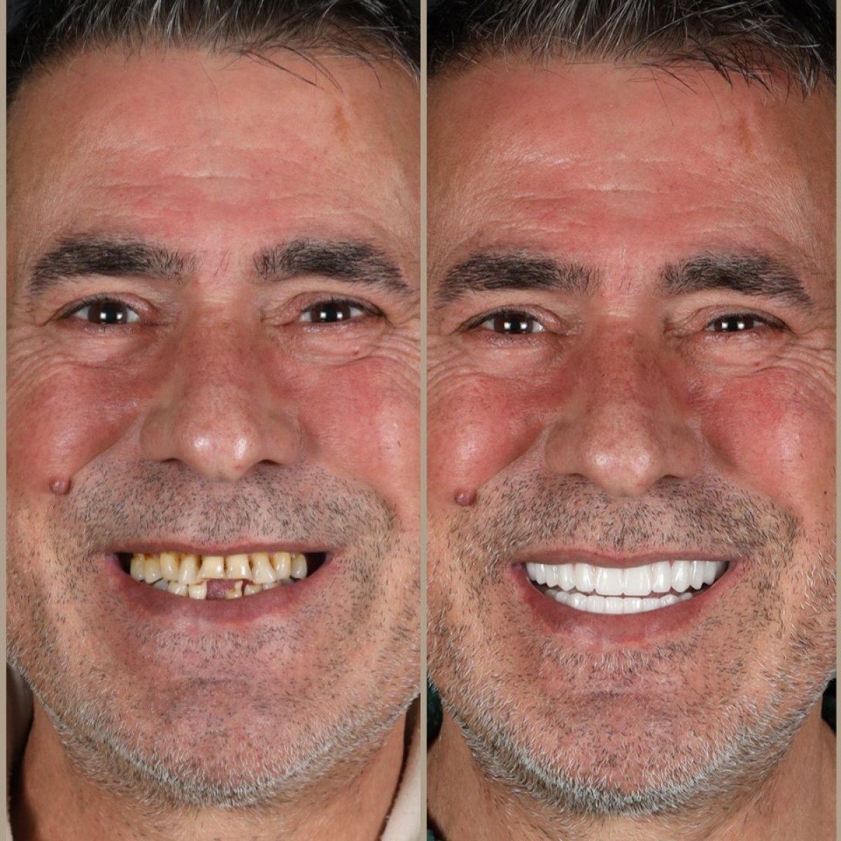 before and after photo