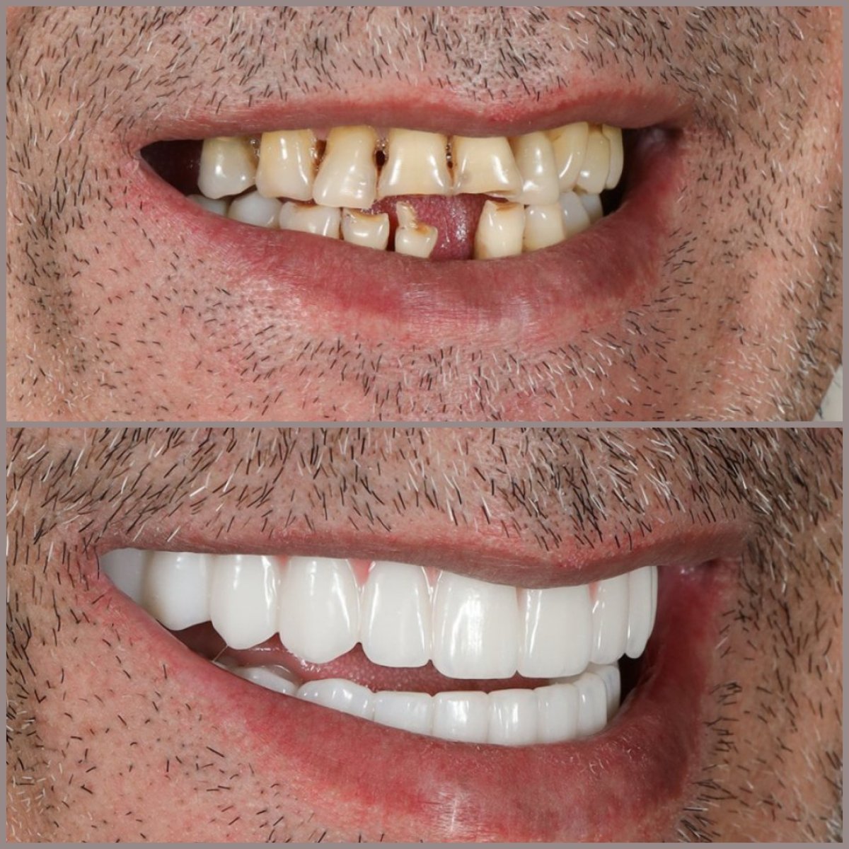 before and after photo