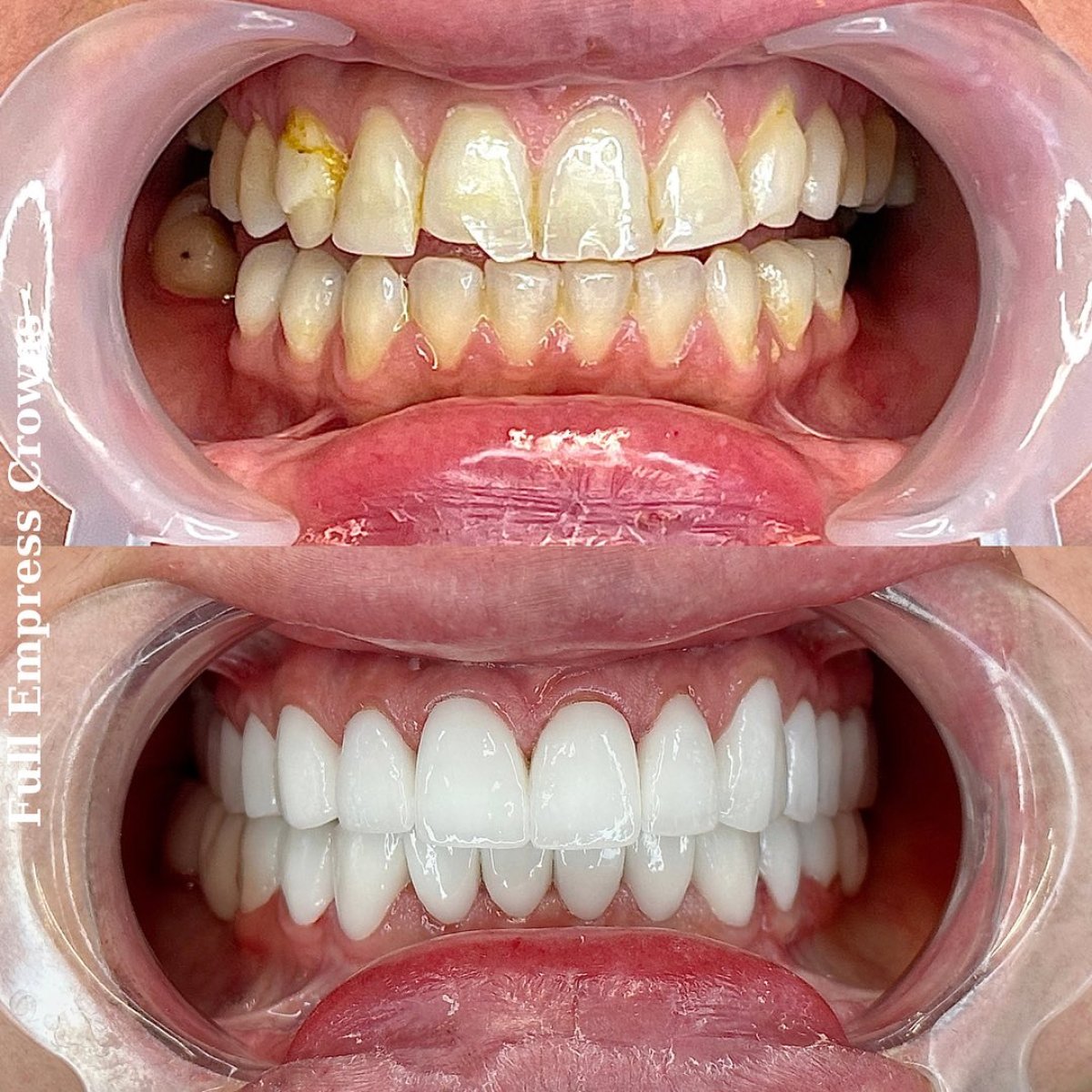 before and after photo