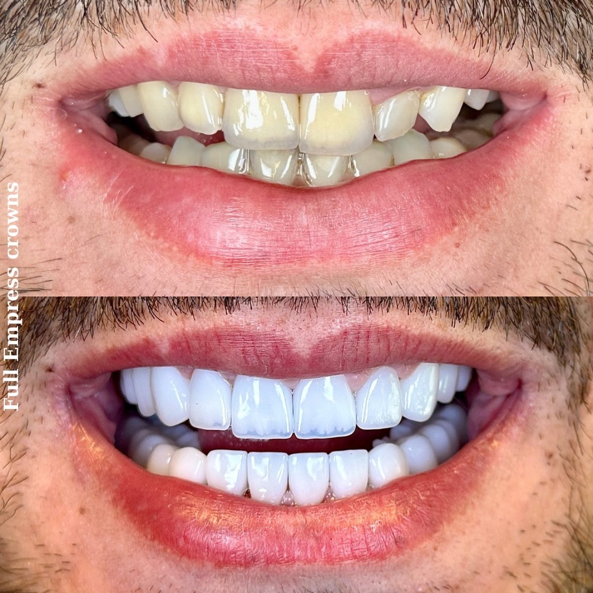 before and after photo