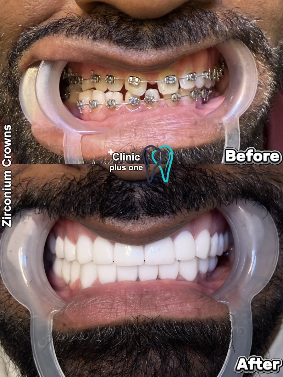 before and after photo