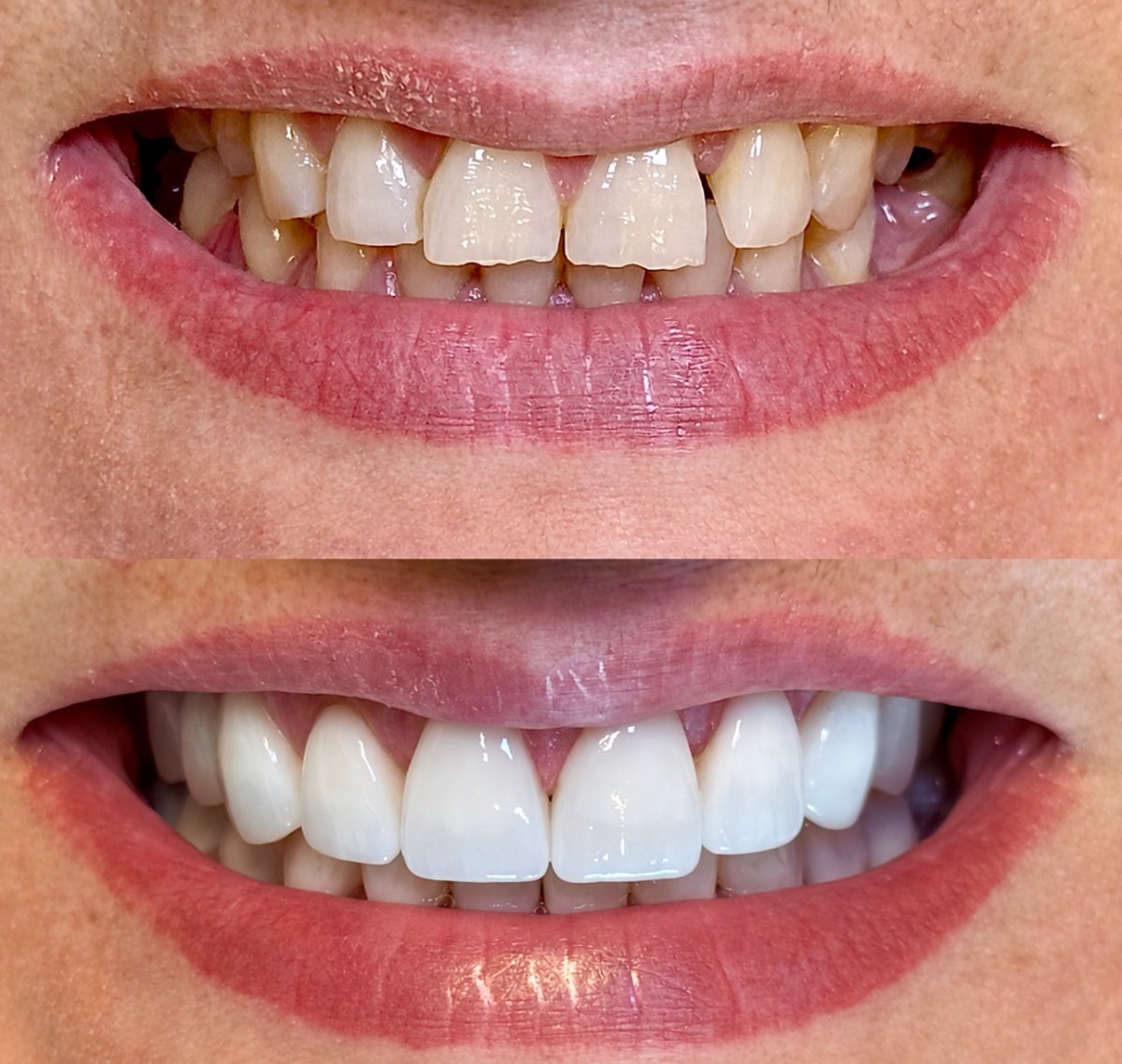 before and after photo