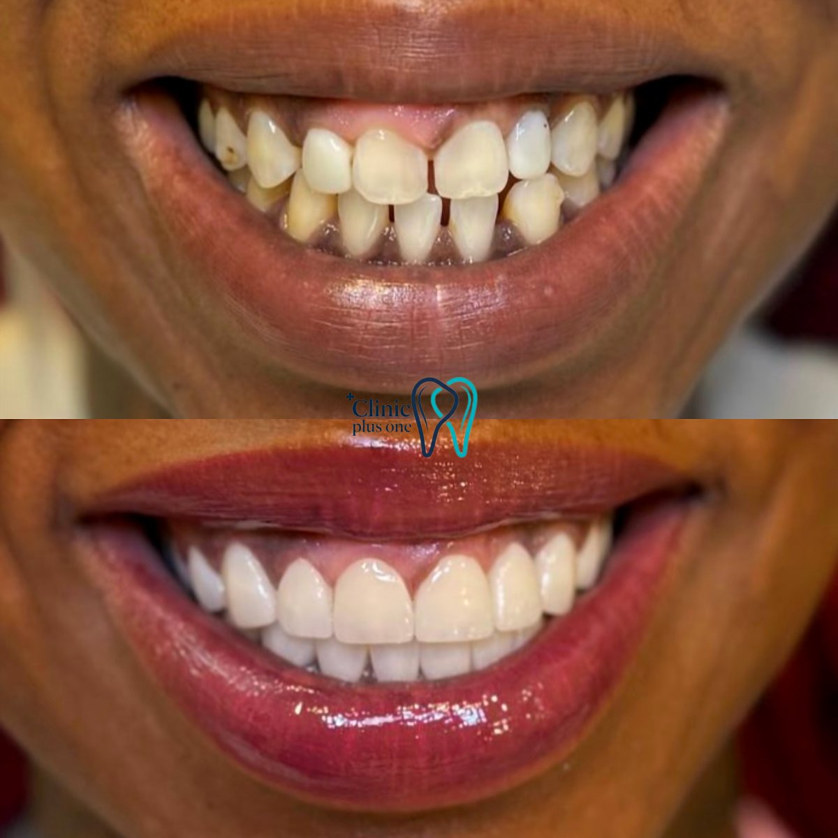 before and after photo