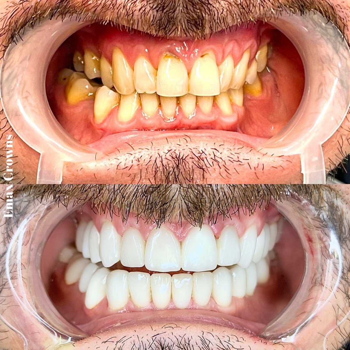 before and after photo