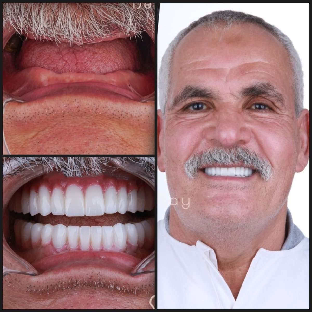 before and after photo