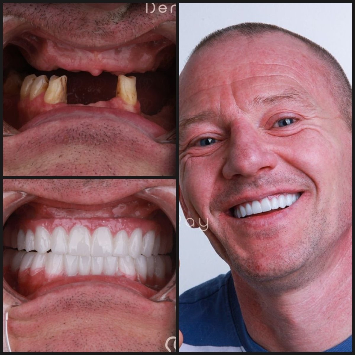 before and after photo