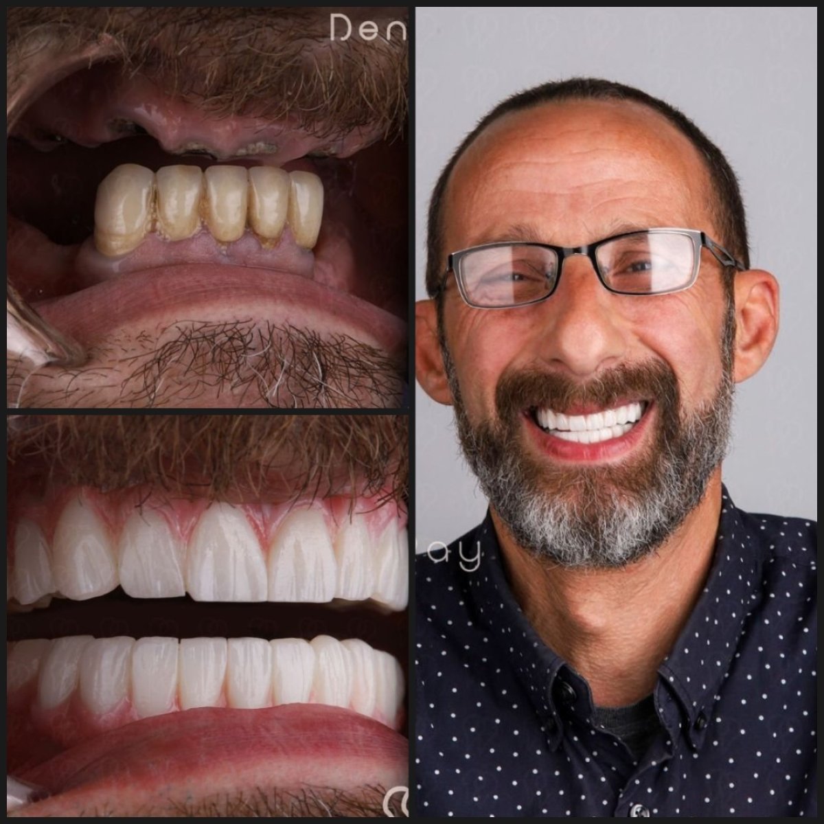 before and after photo