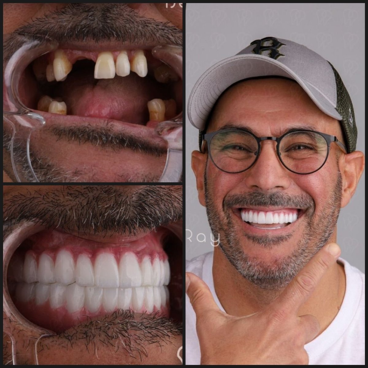 before and after photo