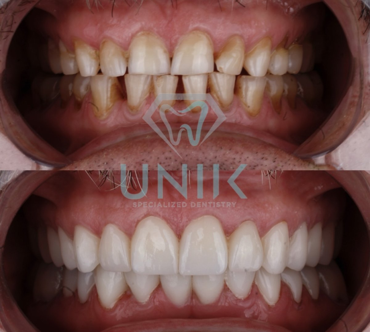before and after photo