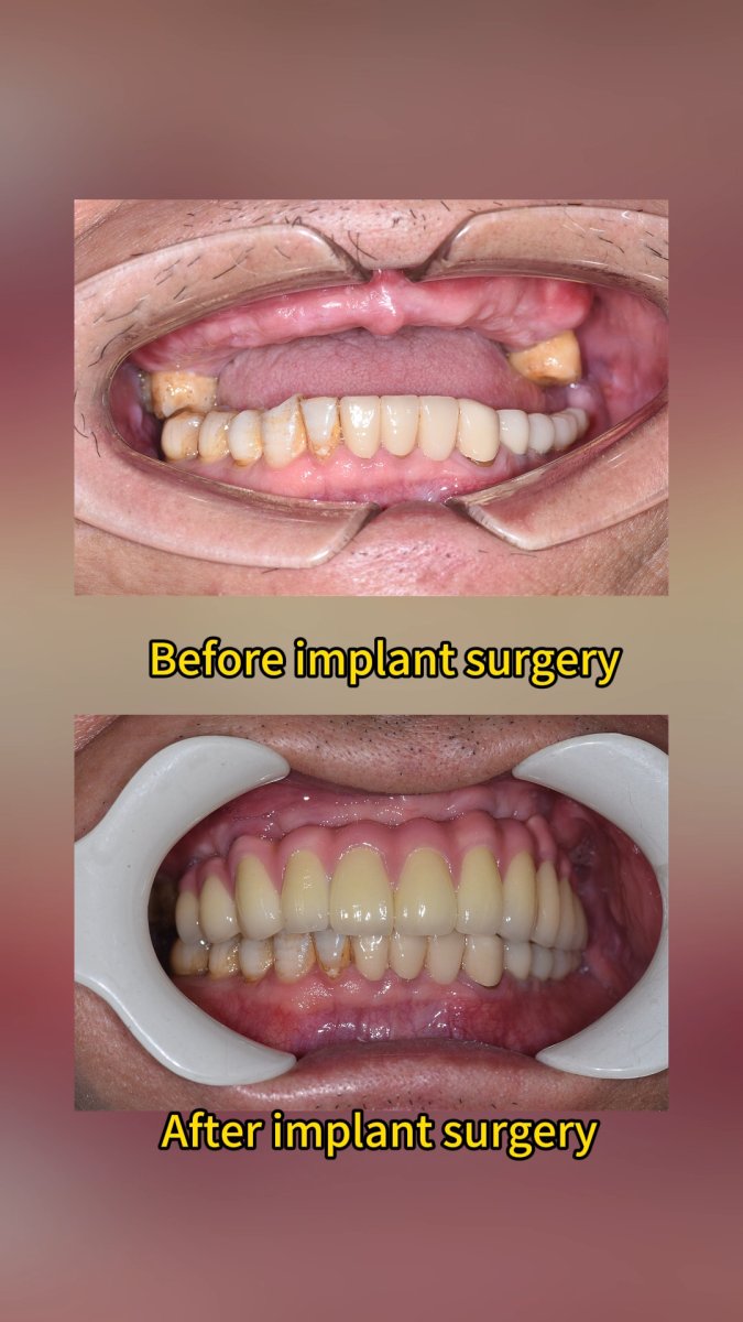 before and after photo