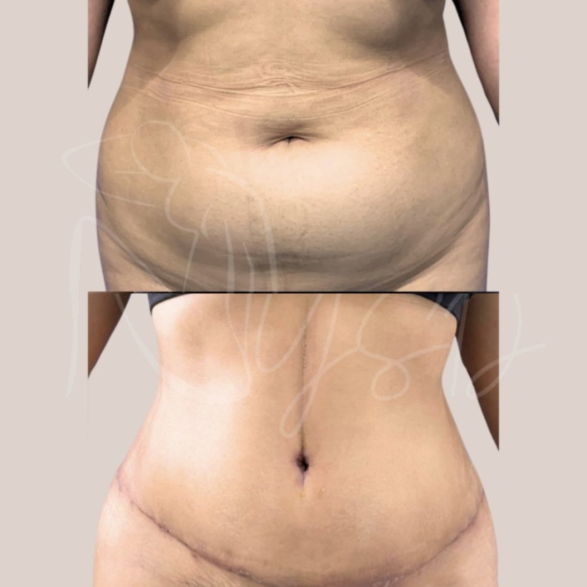 before and after photo