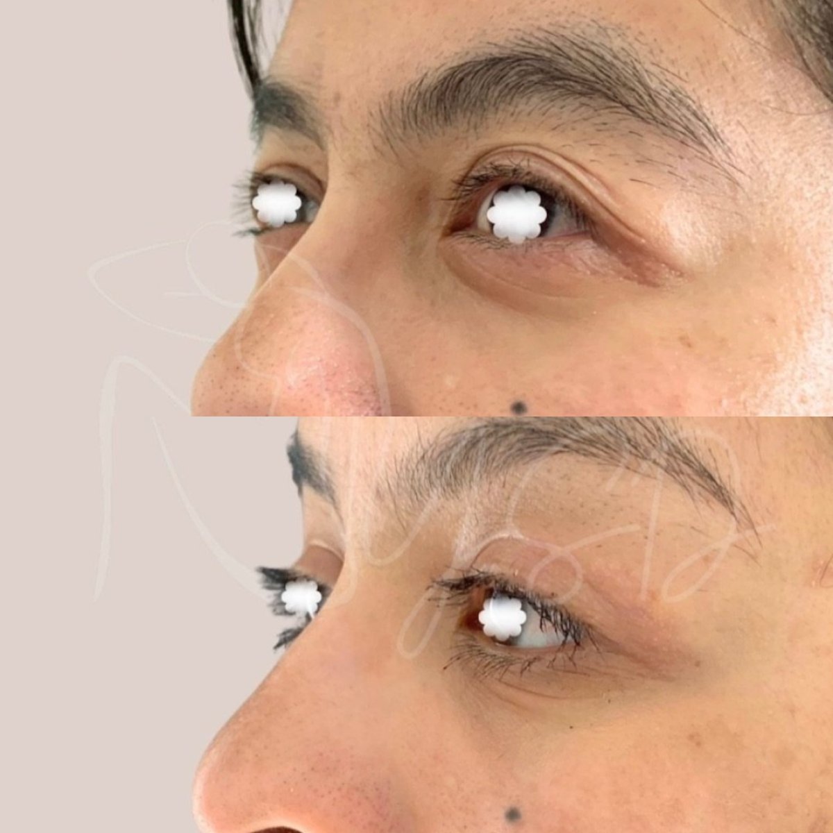 before and after photo