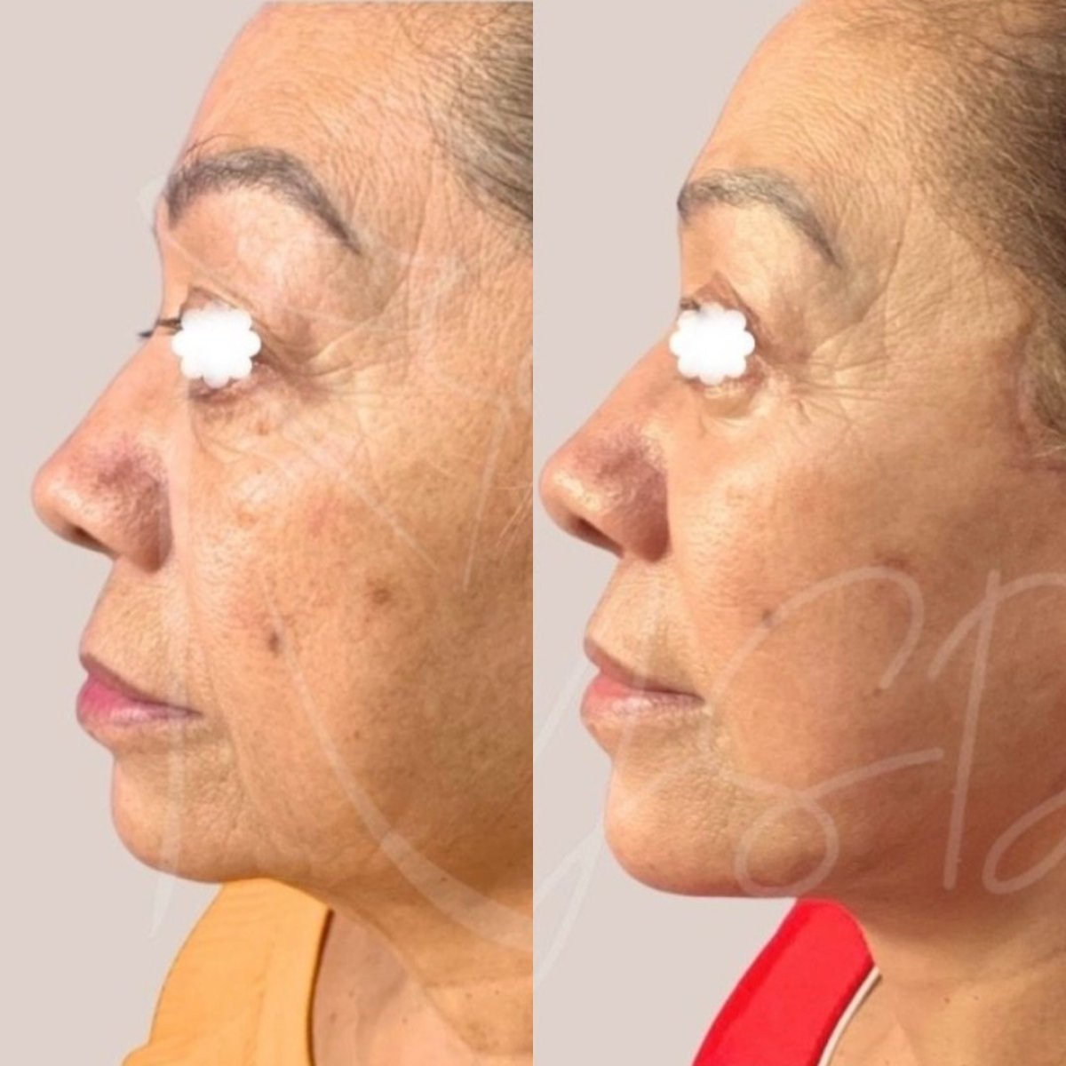 before and after photo
