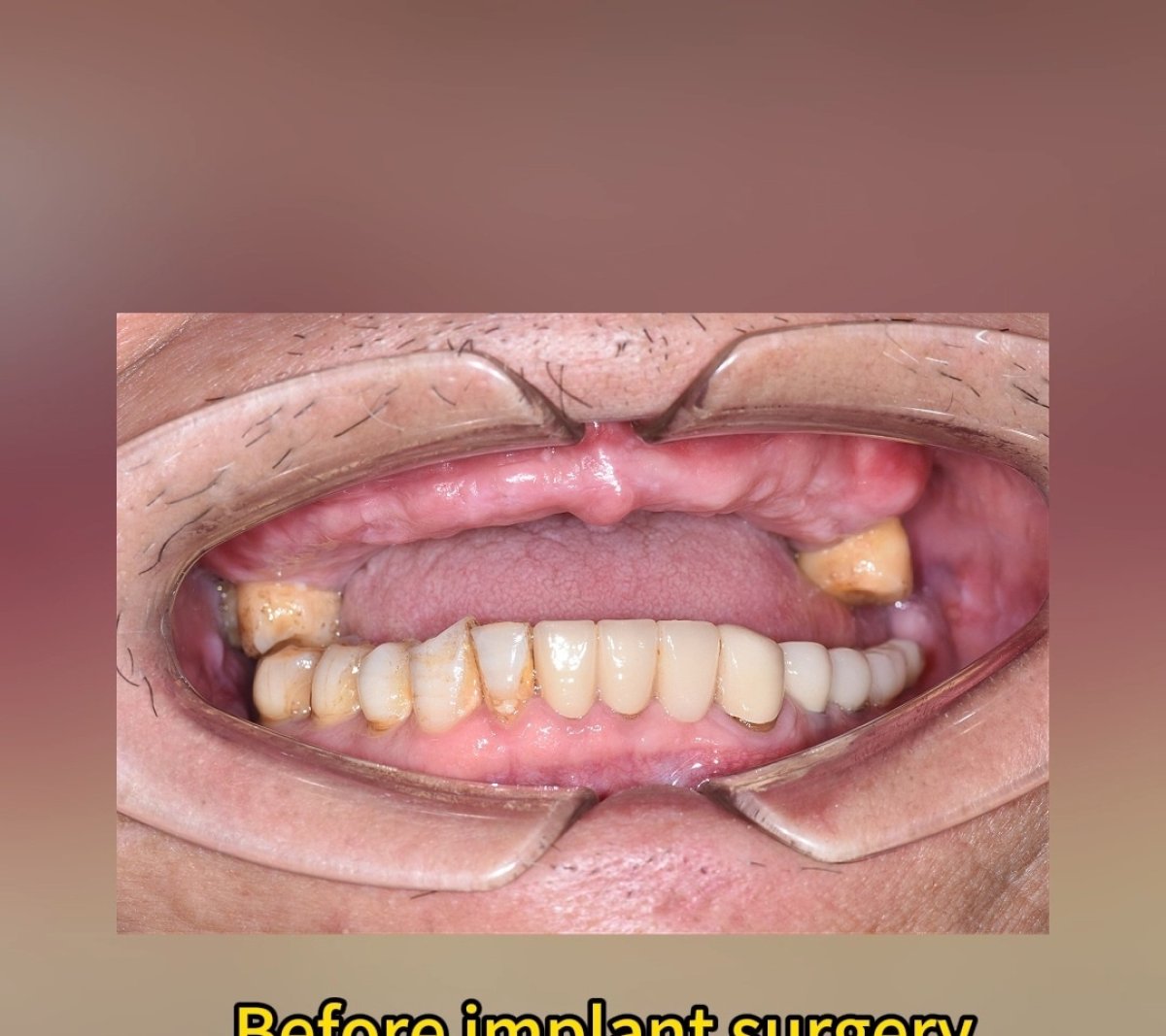 before and after photo