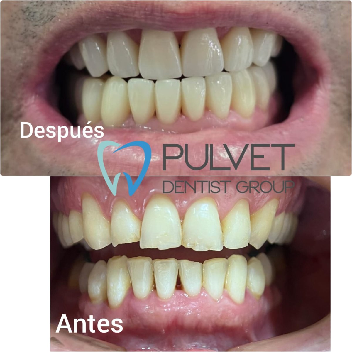 before and after photo